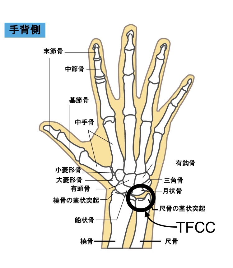 手首を曲げると痛いTFCC損傷の原因と治療法 手首を曲げると痛いTFCC損傷の原因と治療法