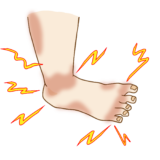 閉塞性動脈硬化症 (ASO) / 手足のしびれ