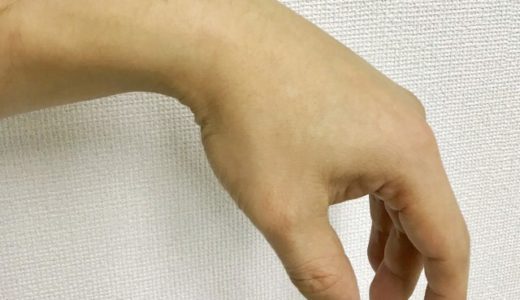 手首が動かない下垂手の原因と治療法