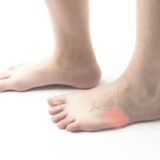 足の外側が痛い短腓骨筋腱付着部炎とは？